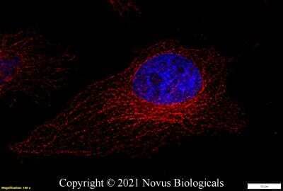 Immunocytochemistry/ Immunofluorescence: alpha Tubulin Antibody (DM1A) - BSA Free [NB100-690]