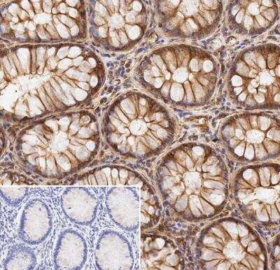 Immunohistochemistry: alpha Tubulin Antibody (DM1A) - BSA Free [NB100-690]