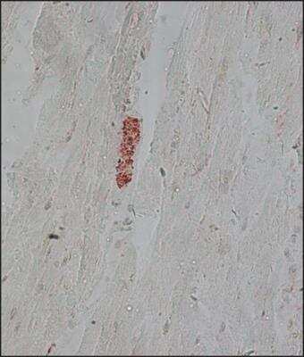 Immunohistochemistry: alpha Tubulin Antibody (DM1A) - BSA Free [NB100-690]