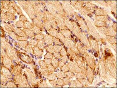 Immunohistochemistry-Paraffin: alpha Tubulin Antibody (DM1A) - BSA Free [NB100-690]