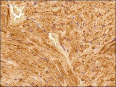 Immunohistochemistry-Paraffin: alpha Tubulin Antibody (DM1A) - BSA Free [NB100-690]