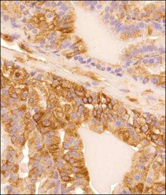 Immunohistochemistry-Paraffin: alpha Tubulin Antibody (DM1A) - BSA Free [NB100-690]