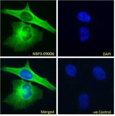 Immunocytochemistry/ Immunofluorescence: alpha Tubulin Antibody (F2C) - Chimeric - Azide and BSA Free [NBP3-09006]