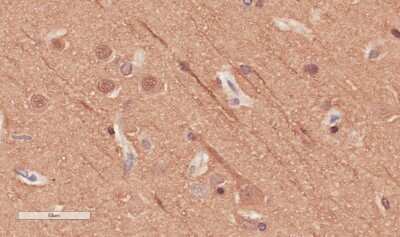 Immunohistochemistry-Paraffin: alpha Tubulin Antibody (F2C) - Chimeric - Azide and BSA Free [NBP3-09006]