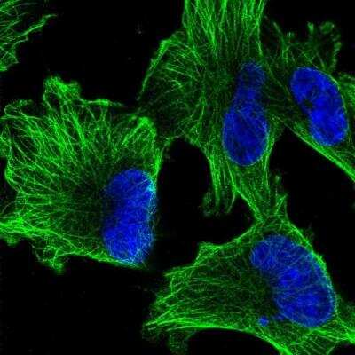 Immunocytochemistry/ Immunofluorescence: alpha Tubulin Antibody [NBP2-54687]