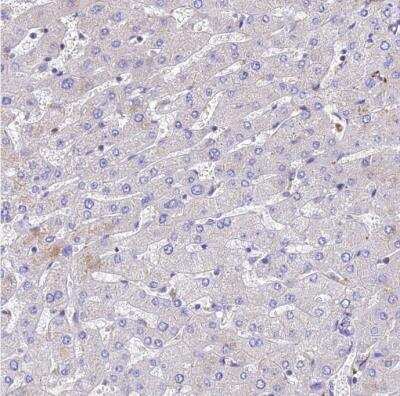 Immunohistochemistry-Paraffin: alpha Tubulin Antibody [NBP2-54687]