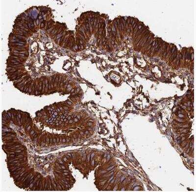 Immunohistochemistry-Paraffin: alpha Tubulin Antibody [NBP2-54687]