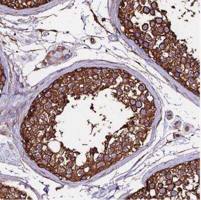 Immunohistochemistry-Paraffin: alpha Tubulin Antibody [NBP2-54687]