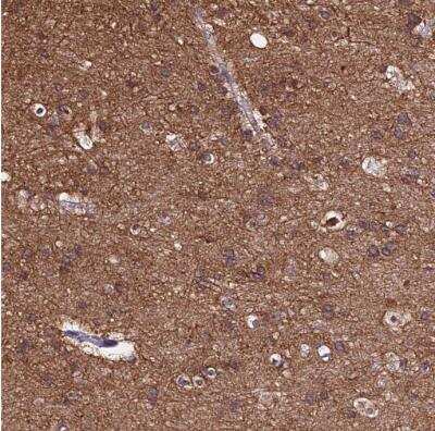 Immunohistochemistry-Paraffin: alpha Tubulin Antibody [NBP2-54687]