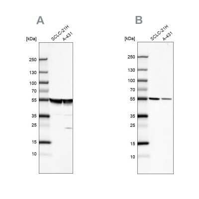 Western Blot: alpha Tubulin Antibody [NBP2-54687]