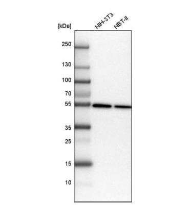 Western Blot: alpha Tubulin Antibody [NBP2-54687]