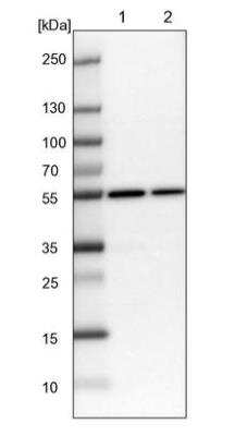 Western Blot: alpha Tubulin Antibody [NBP2-54708]