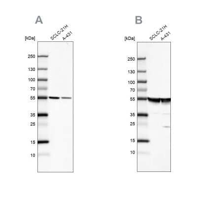 Western Blot: alpha Tubulin Antibody [NBP2-54708]