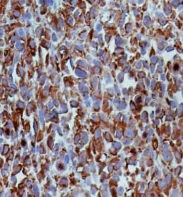 Immunohistochemistry: alpha Tubulin Antibody (YL1/2) - Azide and BSA Free [NBP2-80571]