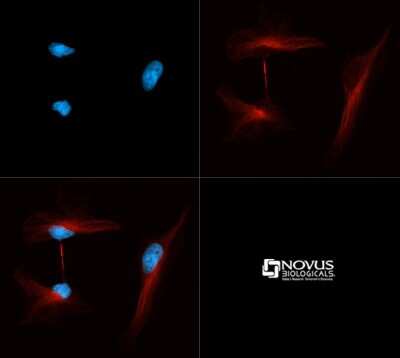 Immunocytochemistry/ Immunofluorescence: alpha Tubulin Antibody (YL1/2) - BSA Free [NB600-506]