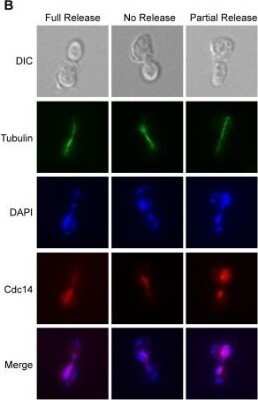 Immunocytochemistry/ Immunofluorescence: alpha Tubulin Antibody (YOL1/34) - Azide and BSA Free [NBP2-80569]