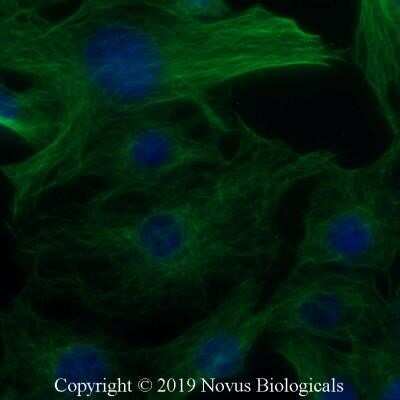 Immunocytochemistry/ Immunofluorescence: alpha Tubulin Antibody (YOL1/34) - Azide and BSA Free [NBP2-80569]