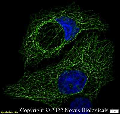 Immunocytochemistry/ Immunofluorescence: alpha Tubulin Antibody (YOL1/34) - BSA Free [NB100-1639]