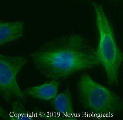 Immunocytochemistry/ Immunofluorescence: alpha Tubulin Antibody (YOL1/34) - BSA Free [NB100-1639]