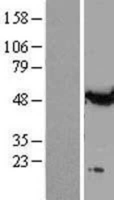 Western Blot: alpha Tubulin Overexpression Lysate [NBL1-17427]