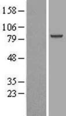 Western Blot: Aminopeptidase O/ONPEP Overexpression Lysate [NBL1-08592]