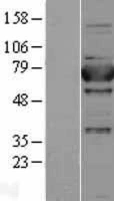 Western Blot: Aminopeptidase P1/XPNPEP1 Overexpression Lysate [NBL1-17908]