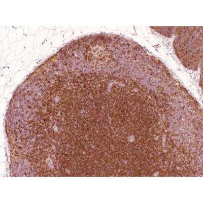 Immunohistochemistry: Horse anti-Mouse IgG ImmPRESS(TM) Secondary Antibody [HRP Polymer] [MP-7402-NB]
