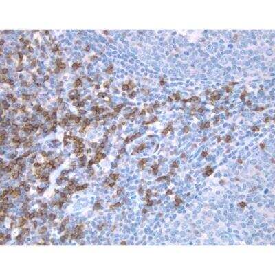 Immunohistochemistry: Horse anti-Mouse IgG ImmPRESS(TM) Secondary Antibody [HRP Polymer] [MP-7402-NB]