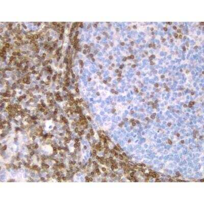 Immunohistochemistry: Horse anti-Mouse IgG ImmPRESS(TM) Secondary Antibody [HRP Polymer] [MP-7402-NB]