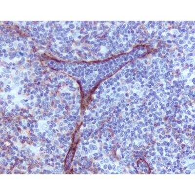 Immunohistochemistry: Horse anti-Mouse IgG ImmPRESS(TM) Secondary Antibody [HRP Polymer] [MP-7402-NB]