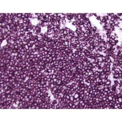 Immunohistochemistry: Horse anti-Mouse IgG ImmPRESS(TM) Secondary Antibody [HRP Polymer] [MP-7402-NB]