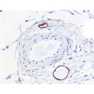 Immunohistochemistry: Horse anti-Mouse IgG ImmPRESS(TM) Secondary Antibody [HRP Polymer] [MP-7402-NB]