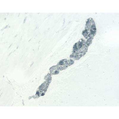 Immunohistochemistry: Horse anti-Mouse IgG ImmPRESS(TM) Secondary Antibody [HRP Polymer] [MP-7402-NB]