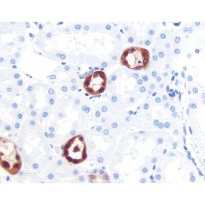 Immunohistochemistry: Horse anti-Mouse IgG ImmPRESS(TM) Secondary Antibody [HRP Polymer] [MP-7402-NB]