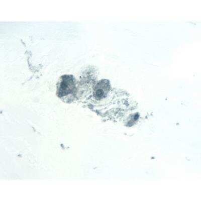 Immunohistochemistry: Horse anti-Mouse IgG ImmPRESS(TM) Secondary Antibody [HRP Polymer] [MP-7402-NB]