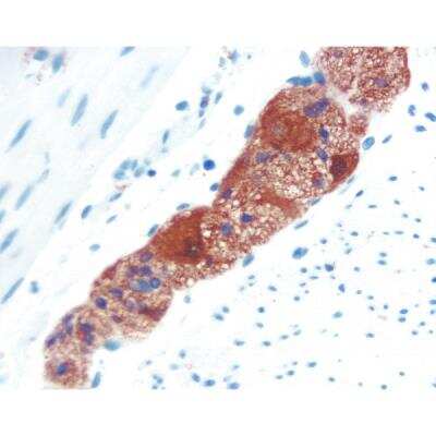 Immunohistochemistry: Horse anti-Mouse IgG ImmPRESS(TM) Secondary Antibody [HRP Polymer] [MP-7402-NB]