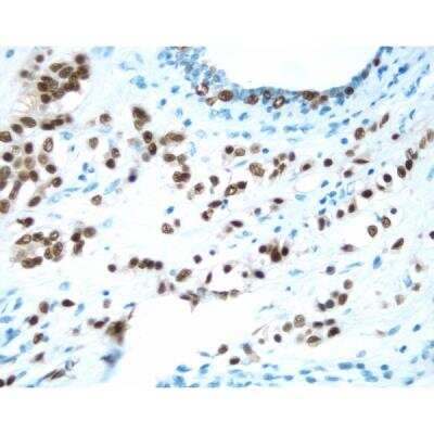 Immunohistochemistry: Horse anti-Mouse IgG ImmPRESS(TM) Secondary Antibody [HRP Polymer] [MP-7402-NB]