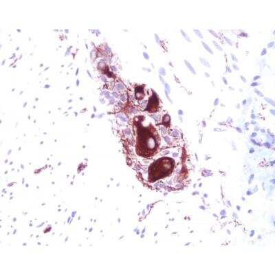 Immunohistochemistry: Horse anti-Mouse IgG ImmPRESS(TM) Secondary Antibody [HRP Polymer] [MP-7402-NB]