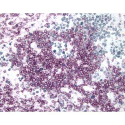 Immunohistochemistry: Horse anti-Mouse IgG ImmPRESS(TM) Secondary Antibody [HRP Polymer] [MP-7402-NB]