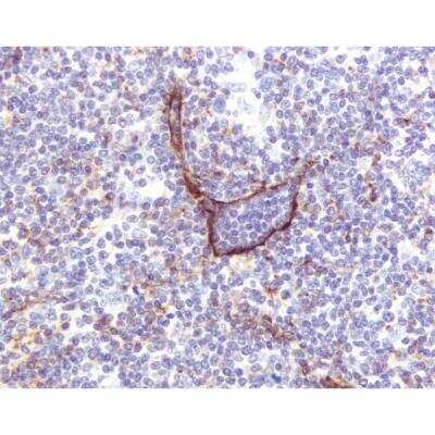 Immunohistochemistry: Horse anti-Mouse IgG ImmPRESS(TM) Secondary Antibody [HRP Polymer] [MP-7402-NB]