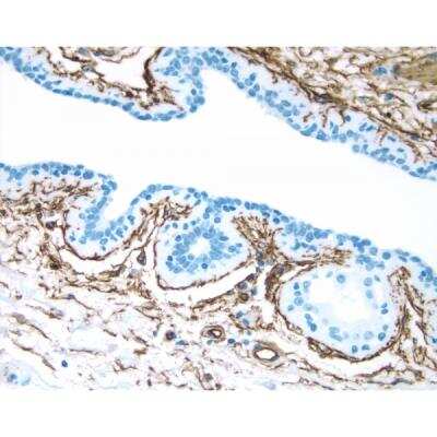 Immunohistochemistry: Horse anti-Mouse IgG ImmPRESS(TM) Secondary Antibody [HRP Polymer] [MP-7402-NB]