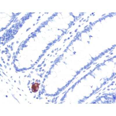 Immunohistochemistry: Horse anti-Mouse IgG ImmPRESS(TM) Secondary Antibody [HRP Polymer] [MP-7402-NB]