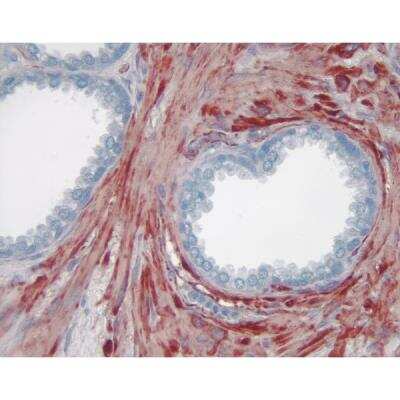 Immunohistochemistry: Horse anti-Mouse IgG ImmPRESS(TM) Secondary Antibody [HRP Polymer] [MP-7402-NB]