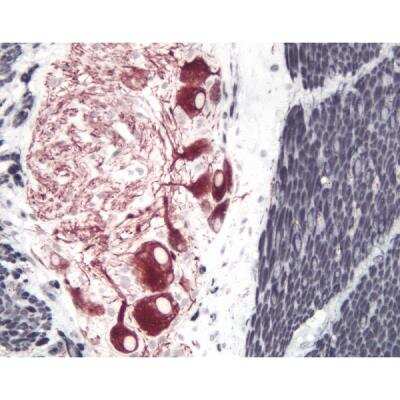 Immunohistochemistry: Horse anti-Mouse IgG ImmPRESS(TM) Secondary Antibody [HRP Polymer] [MP-7402-NB]