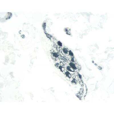 Immunohistochemistry: Horse anti-Mouse IgG ImmPRESS(TM) Secondary Antibody [HRP Polymer] [MP-7402-NB]