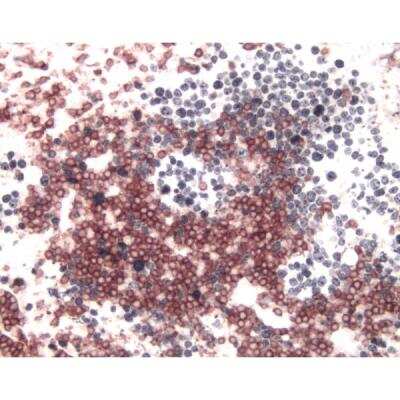 Immunohistochemistry: Horse anti-Mouse IgG ImmPRESS(TM) Secondary Antibody [HRP Polymer] [MP-7402-NB]
