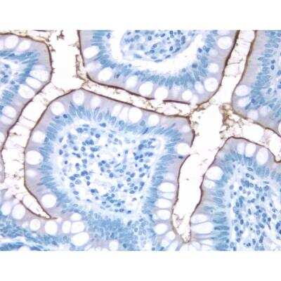 Immunohistochemistry: Horse anti-Mouse IgG ImmPRESS(TM) Secondary Antibody [HRP Polymer] [MP-7402-NB]