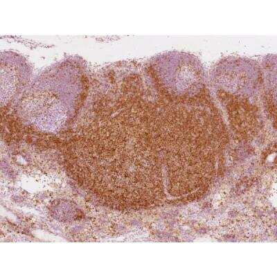Immunohistochemistry: Horse anti-Mouse IgG ImmPRESS(TM) Secondary Antibody [HRP Polymer] [MP-7402-NB]