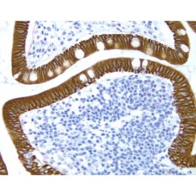 Immunohistochemistry: Horse anti-Mouse IgG ImmPRESS(TM) Secondary Antibody [HRP Polymer] [MP-7402-NB]