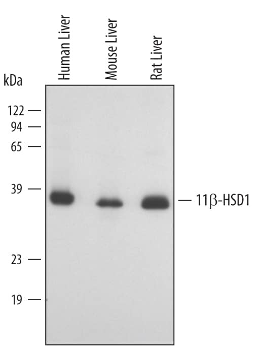 Detection of Human/Mouse/Rat 11 beta-HSD1 antibody by Western Blot.